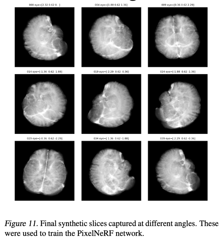 Synthetic MRI brain slices rendered at different viewing angles by the trained PixelNeRF model